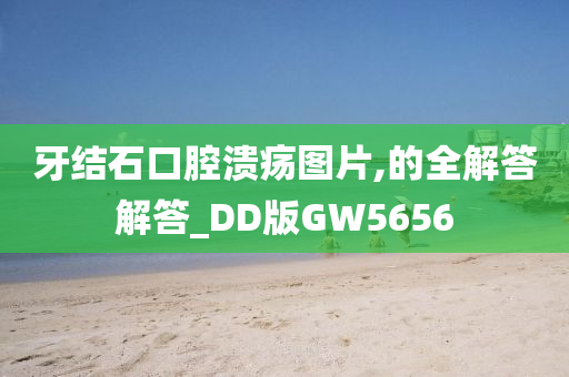 牙结石口腔溃疡图片,的全解答解答_DD版GW5656